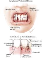 My Smile Doctors - Dentist parramatta image 4